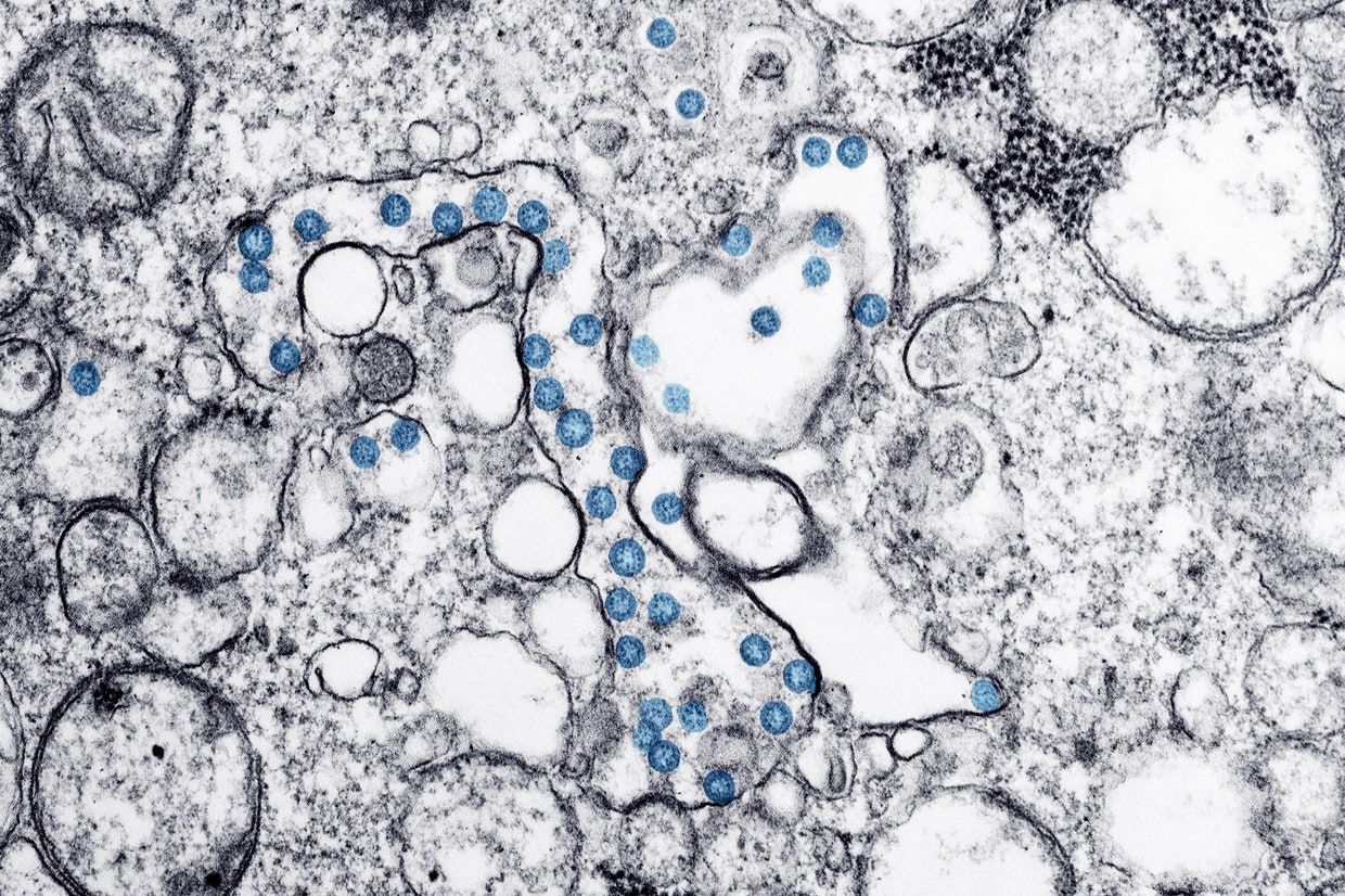 新型コロナウイルス感染症「COVID-19」の米国初の患者から分離した菌の透過電子顕微鏡写真。PHOTOGRAPH BY HANNAH A BULLOCK; AZAIBI TAMIN/CDC